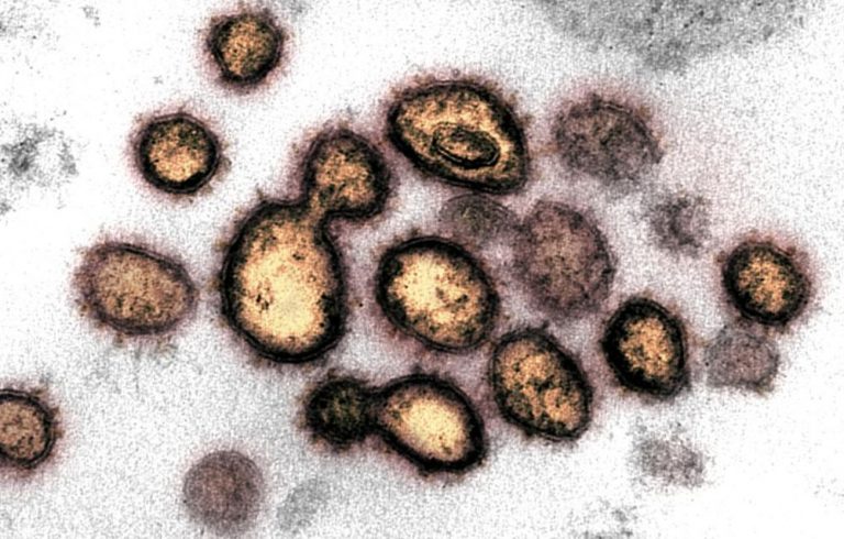 Novel coronavirus survives 28 days on glass, currency, Australian researchers find