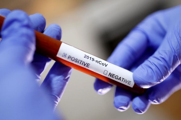 Indian, S.African coronavirus variants found in Americas, says WHO expert