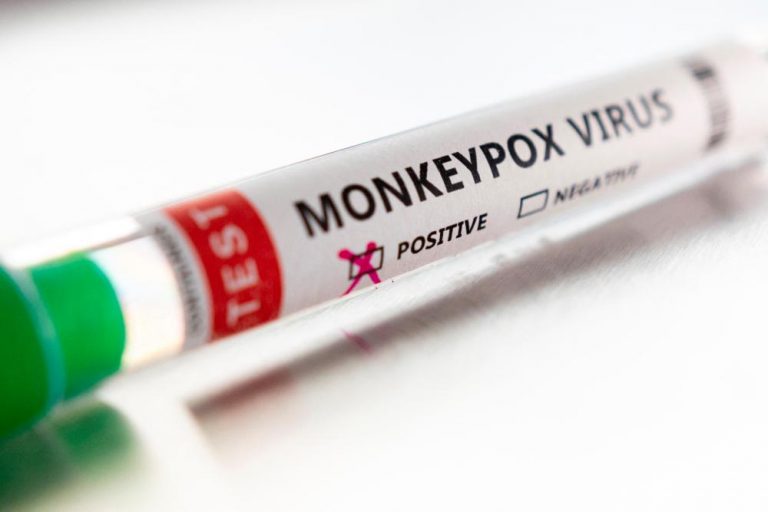 Third possible case of monkeypox found in the US